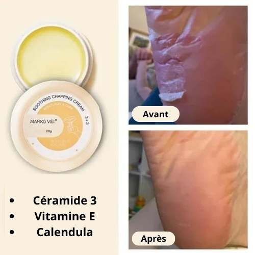 Crème Réparatrice Anti-gerçures pour les Pieds et les Mains